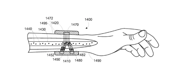 Google : Un brevet pour une montre connectée anti-cancer ?