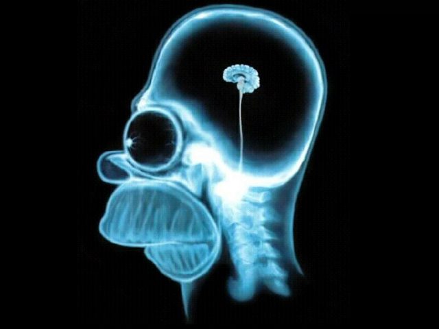 Cerveau Homer